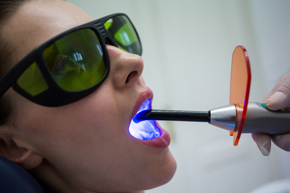 Laser Root Canal Treatment
